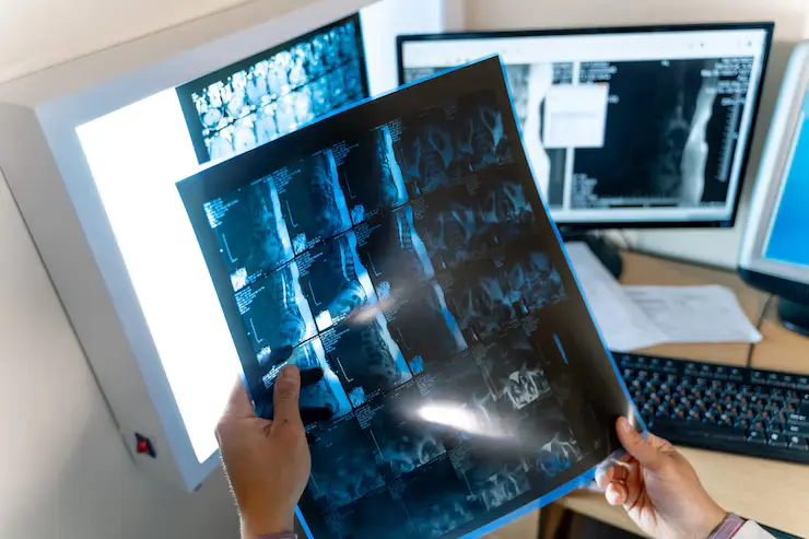 What Is a Radiology Second Opinion and When Should You Get One?
