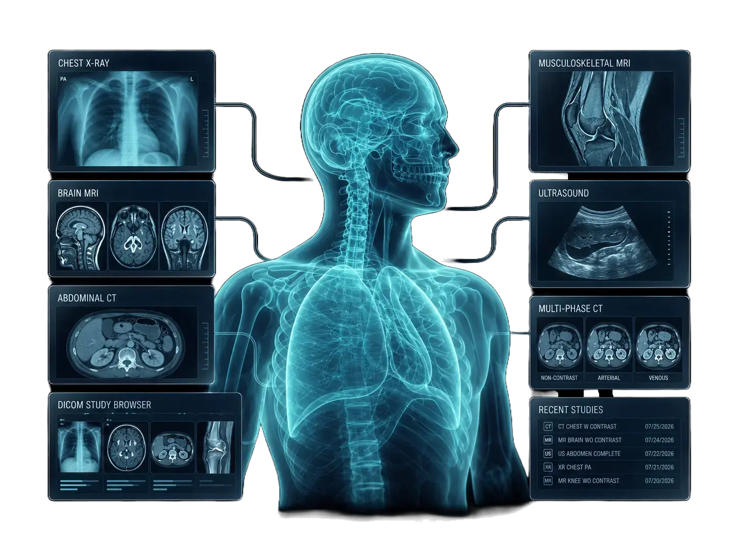 Radiologist reviewing CT, MRI and X-ray images on a digital workstation for a radiology second opinion.